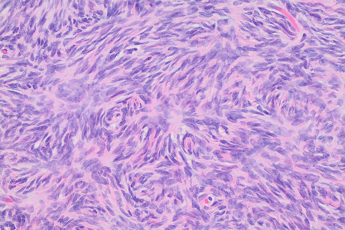 Imagem de microscópio em tons de roxo e rosa mostrando células alongadas dispostas em redemoinhos