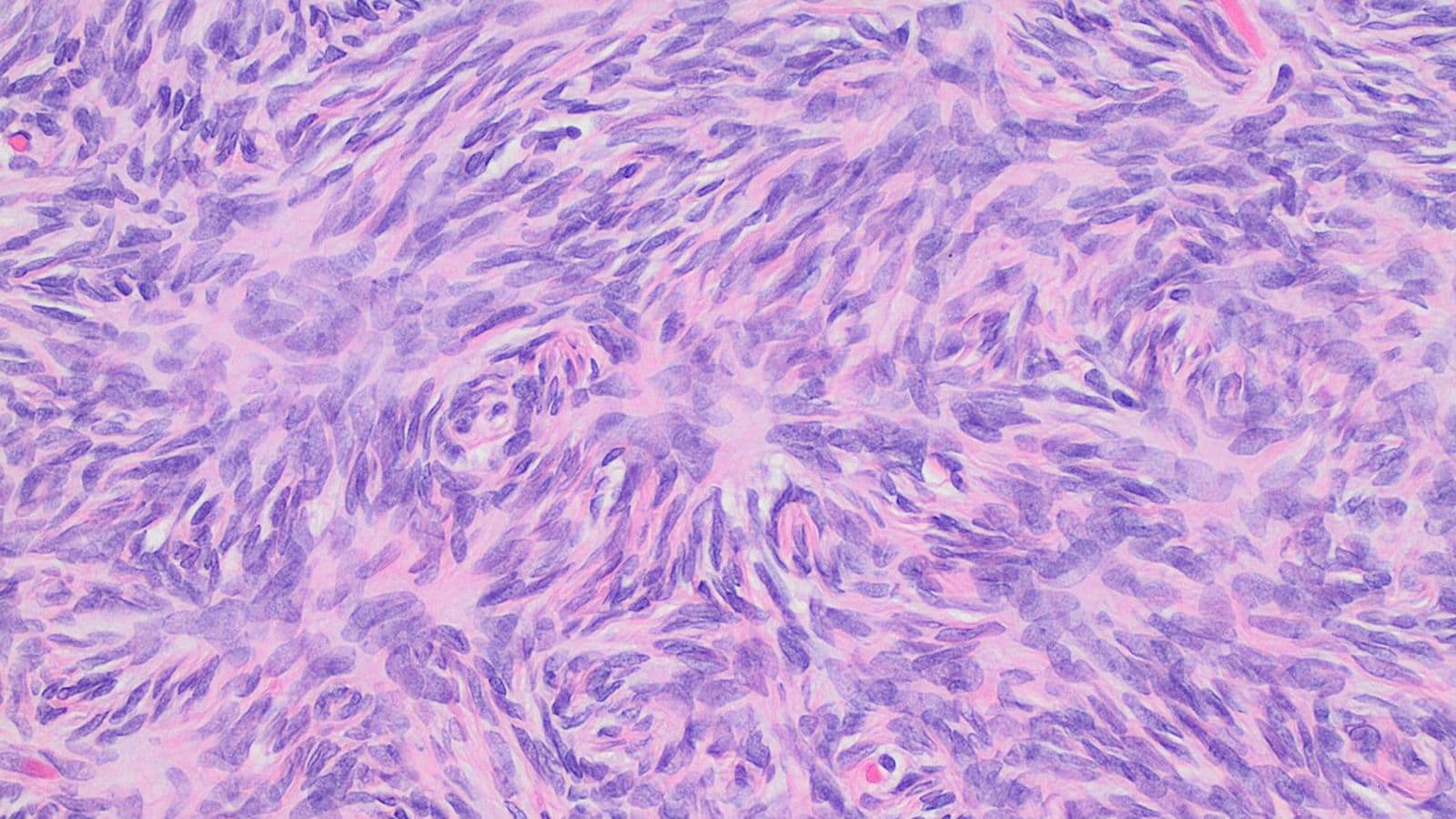 Imagem de microscópio em tons de roxo e rosa mostrando células alongadas dispostas em redemoinhos