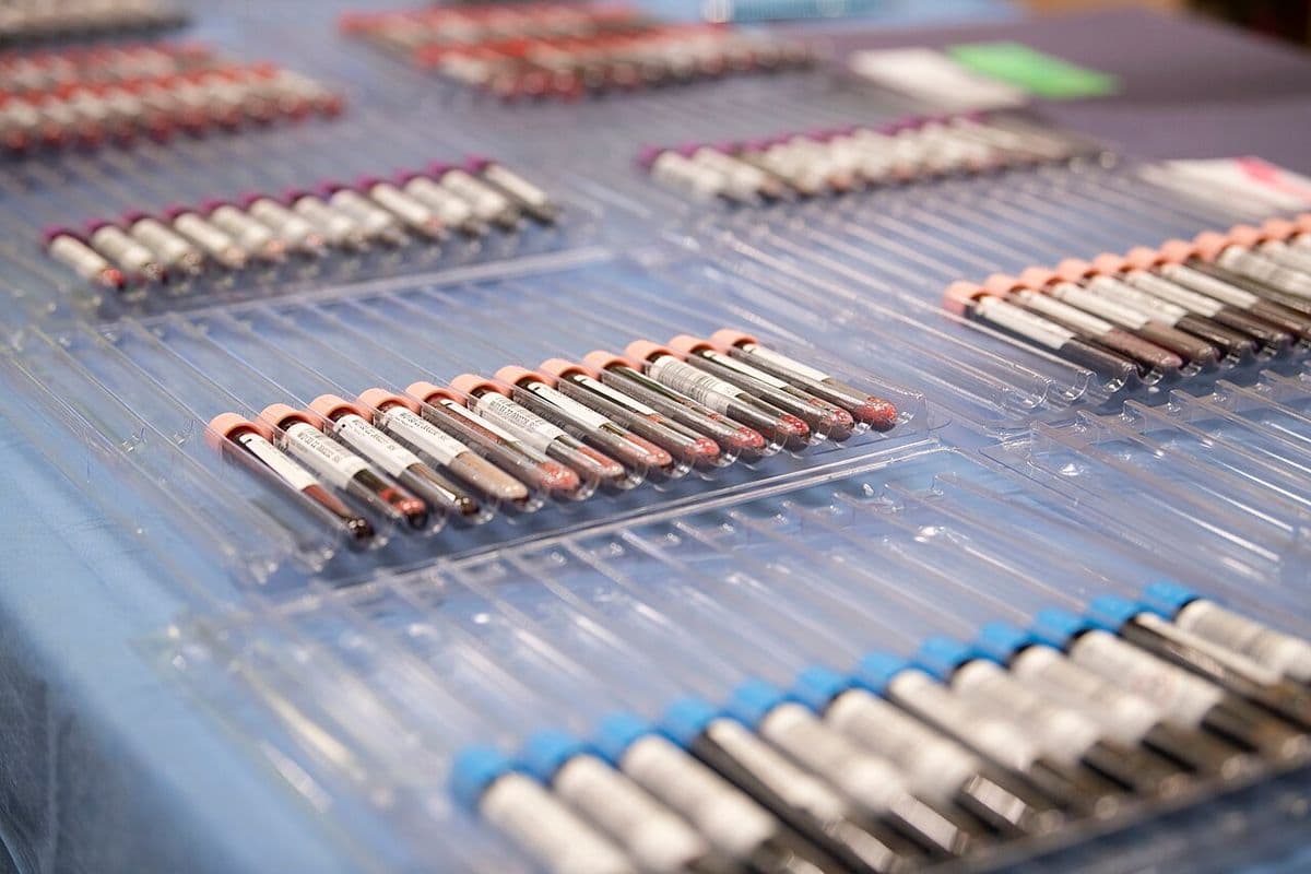 Dezenas de tubos de coleta de sangue com tampas coloridas enfileirados em bandejas plásticas
